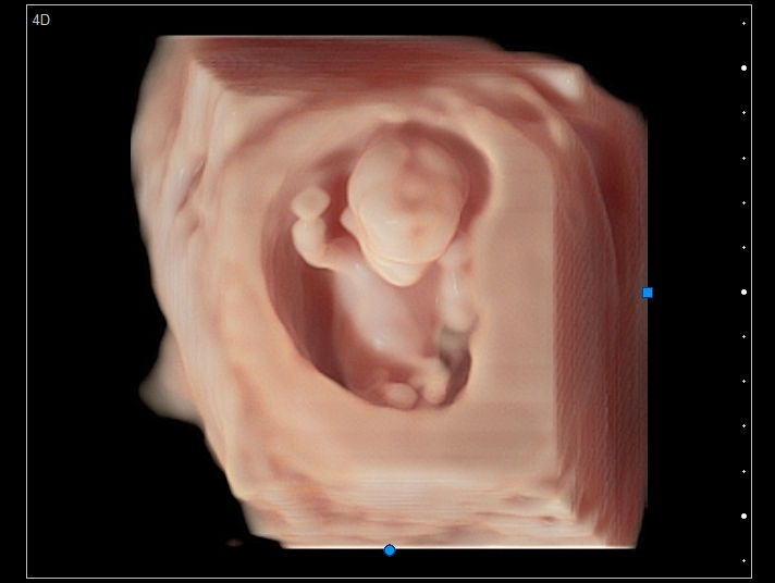 The Science of Baby Kicks What Do They Mean and Why They Happen