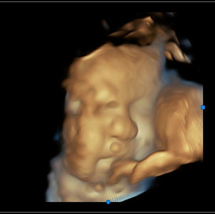 39 weeks pregnant 3D ultrasound picture of baby's face