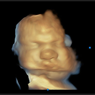 37 weeks 4 days pregnant 3d ultrasound picture of baby's face