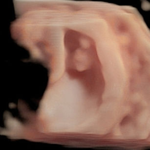 3D Ultrasound Picture at 8 Weeks 3 Days Pregnant of the baby in the uterus in virtual HD