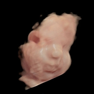 3D Ultrasound at 30 weeks 5 days pregnant of baby's face in virtual HD