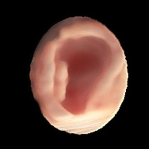 3D ultrasound picture at 8 weeks 5 days pregnant of baby in the uterus in virtual HD