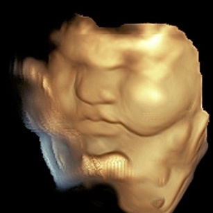 39 weeks 4 days pregnant of a 3d ultrasound picture of baby's face nose lips and cheeks