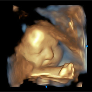 35 weeks 1 day pregnant 3D Ultrasound Picture of baby's face