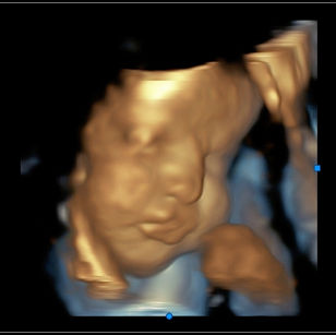35 weeks 3 days pregnant 3D Ultrasound Picture of baby's face