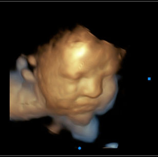 38 weeks 4 days pregnant 3D ultrasound of baby's face
