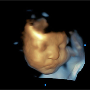 35 weeks 3 days pregnant 3D Ultrasound Picture of baby's face