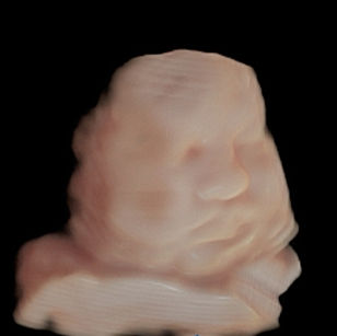 35 weeks 6 days pregnant 3d ultrasound picture baby face in virtual HD