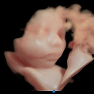3d ultrasound picture 29 weeks 6 days picture baby's face in virtual HD