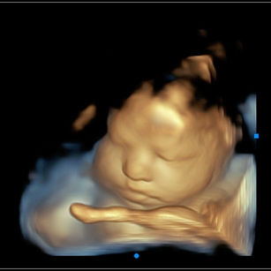35 weeks 2 days pregnant 3D Ultrasound Picture of baby's face