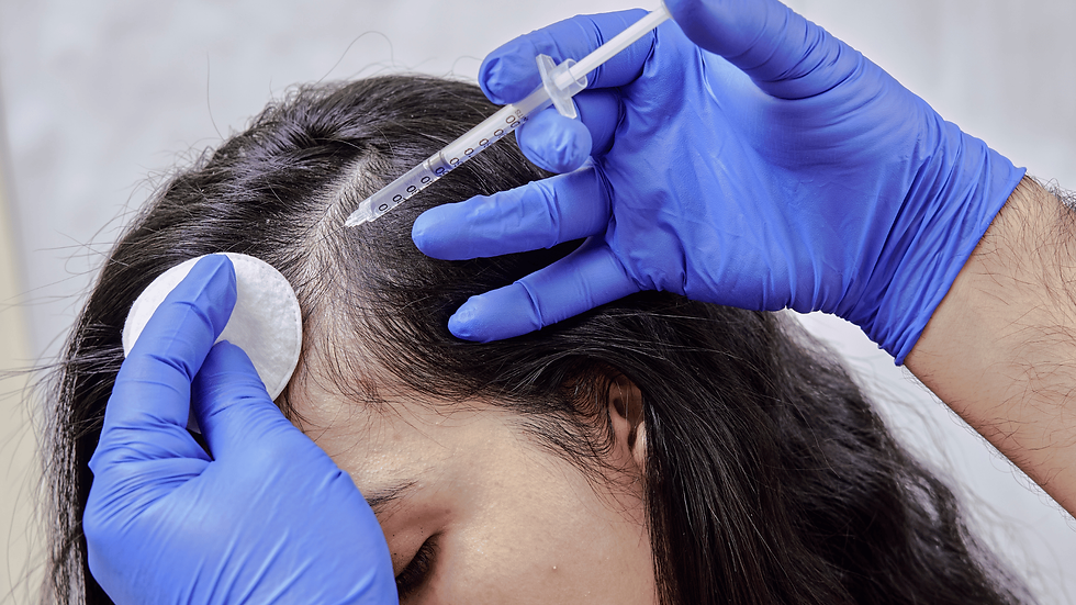 Hair loss treatment