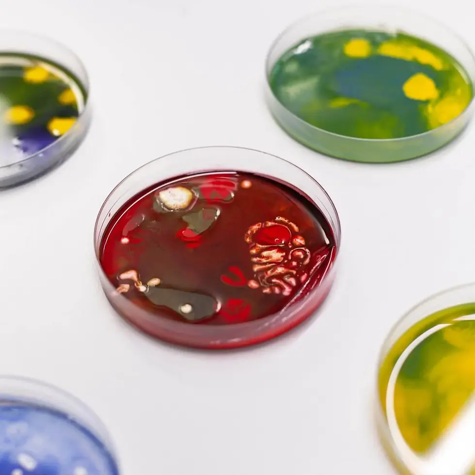 petri-dish-laboratory-glass-plates-with-bacteria