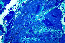 Blue Abstract Patterns