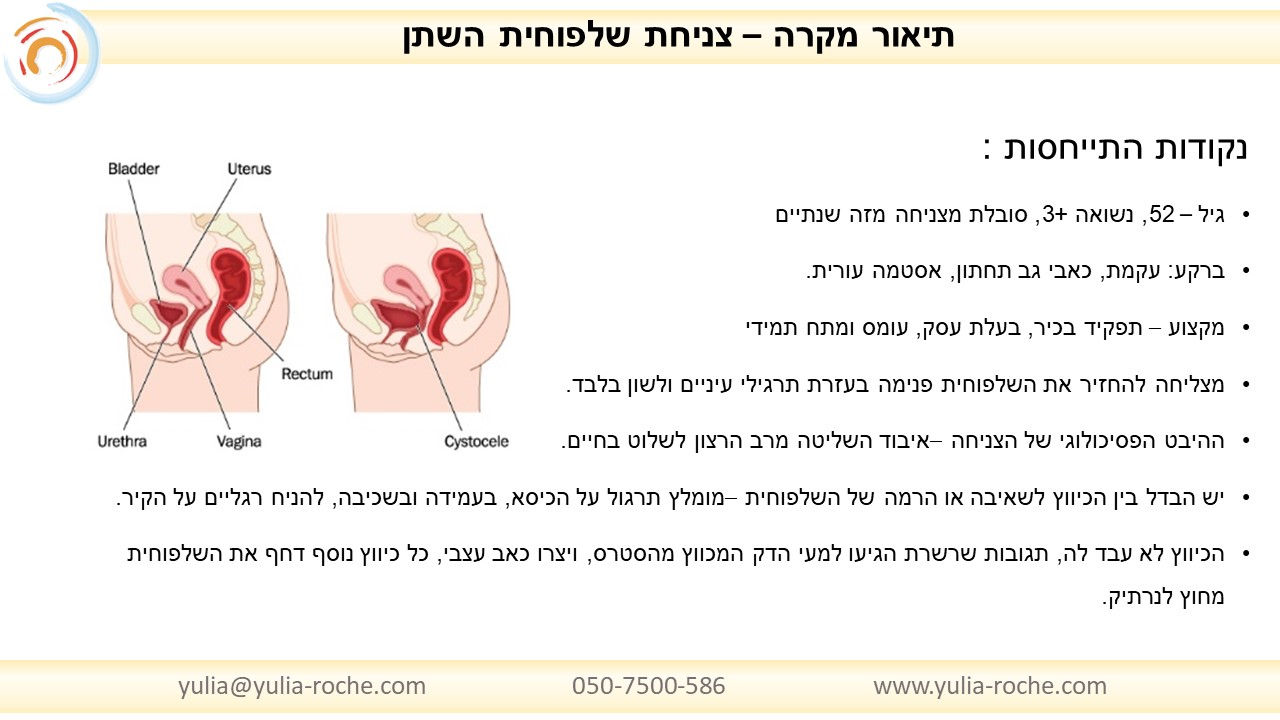 שקופית13