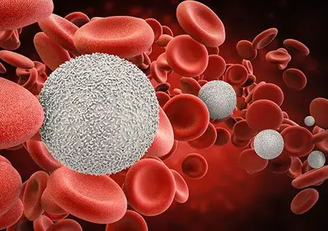 Anemia: causes, symptoms, diagnosis, and treatment.