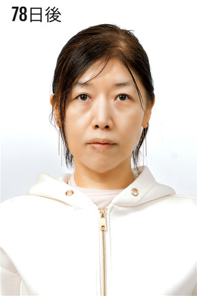 78日後