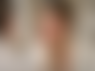 I Destroyed My Skin Barrier With Acids – How I Fixed It (Dermatology-Backed 3-Step Reset)