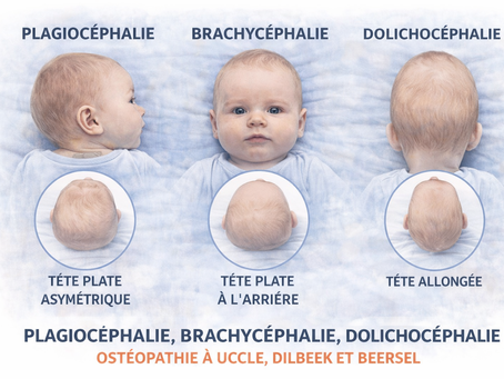 Plagiocéphalie, brachycéphalie, dolichocéphalie chez le bébé