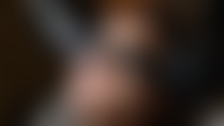 Why Your Laser Is Losing Power — And What It’s Really Costing Your Practice