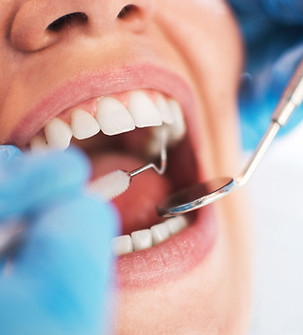 Dental Check up.jpg