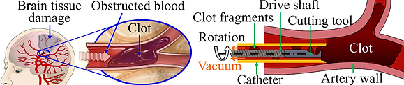 clot buster.png