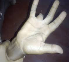 The Boney Finger