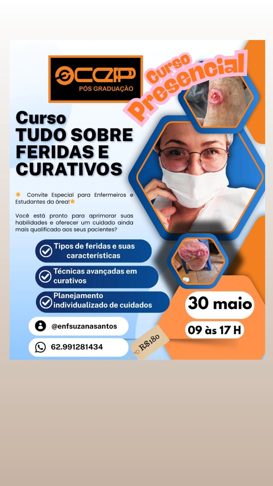 TUDO SOBRE FERIDAS E CURATIVOS