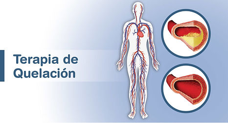 Terapia-de-Quelacion-1-1024x551.jpeg