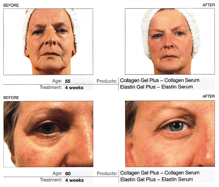 Thumbnail: Clayton Shagal Elastin Gel Plus