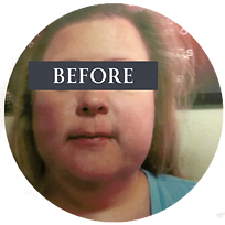 Microcurrent Before After_edited.png
