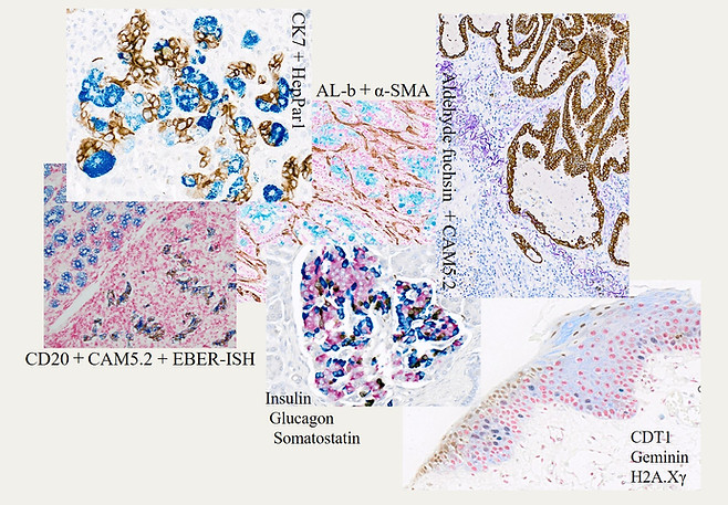 柳田絵美衣が染色した病理標本画像。