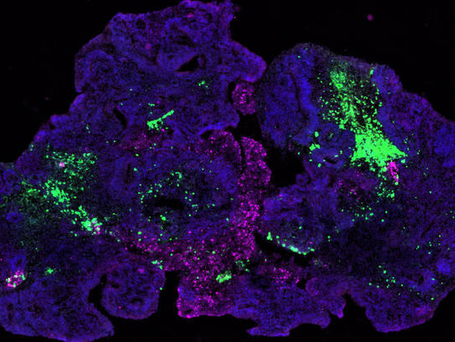 From Frankenstein to Organoids: How Science is Recreating Life’s Complex Systems