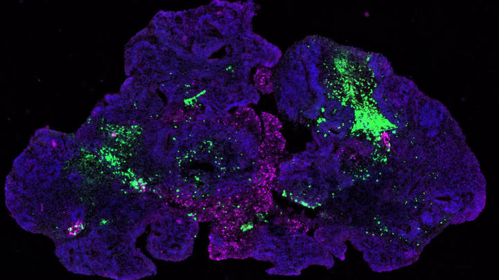 From Frankenstein to Organoids: How Science is Recreating Life’s Complex Systems