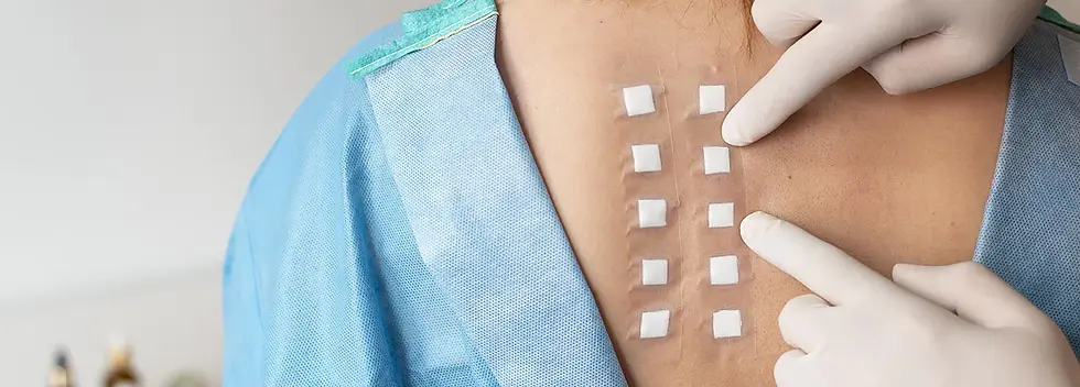 Prick-Test-e-Patch-Test.webp