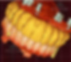Dental implants