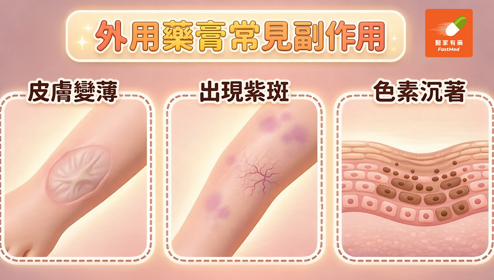 長期不當使用強效濕疹藥膏(類固醇)後可能出現的常見副作用,皮膚變薄且出現明顯的微血管。