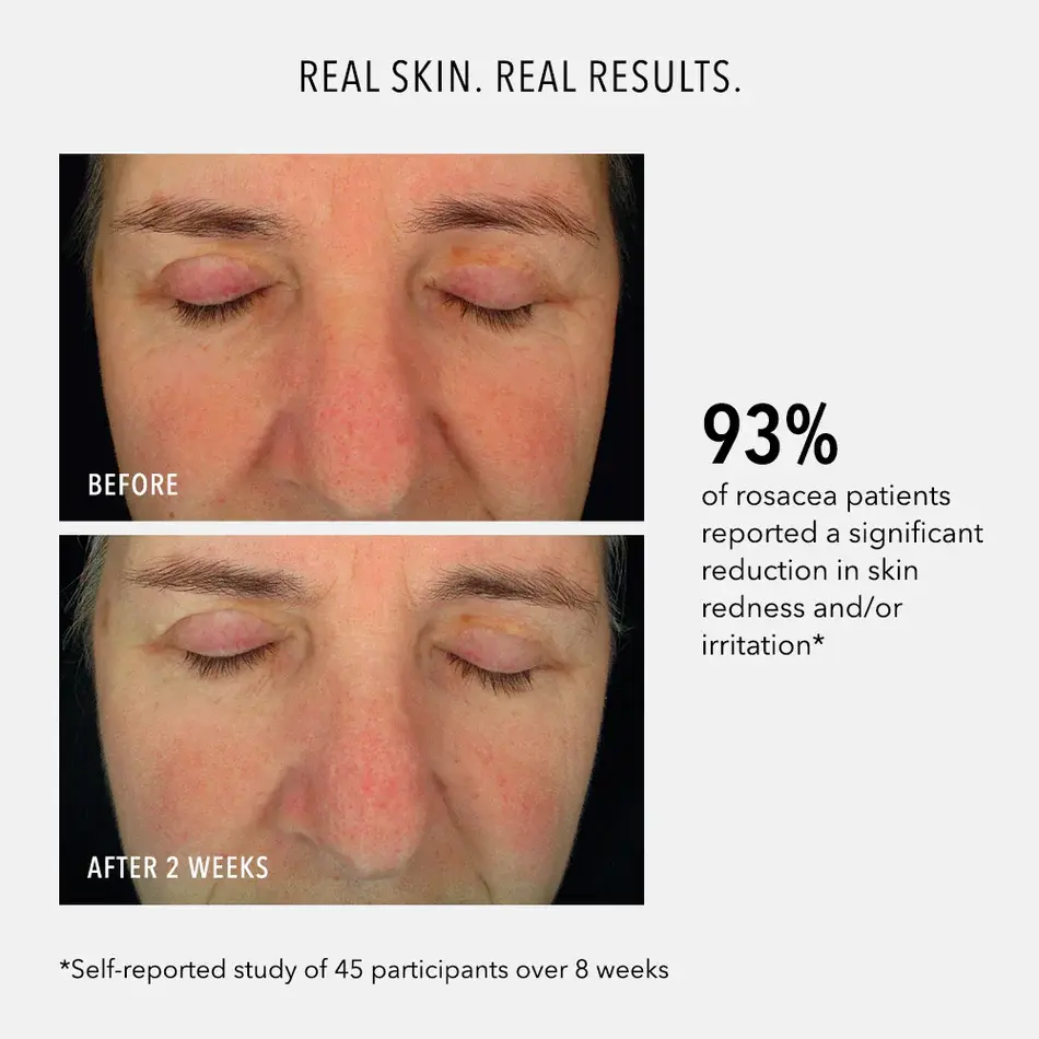 Thumbnail: HydroPeptide Soothing Face Serum (30ml)