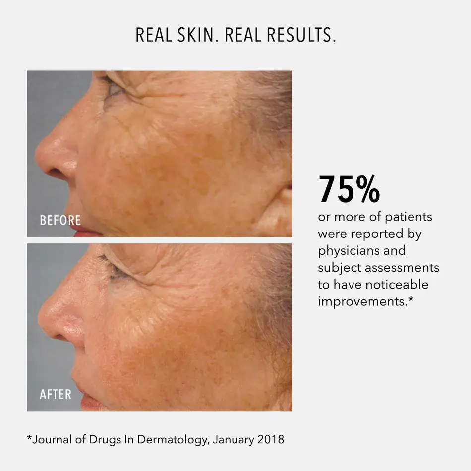 Thumbnail: HydroPeptide LumaPro-C Serum (30ml)