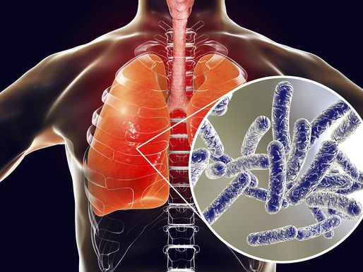 Legionella groeisnelheid: Wat beïnvloedt de vermenigvuldigingssnelheid van legionella?