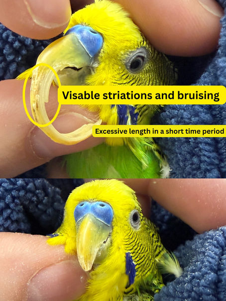 What is Fatty Liver Disease?