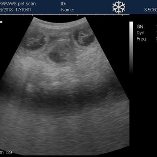 Ultersound scan image
