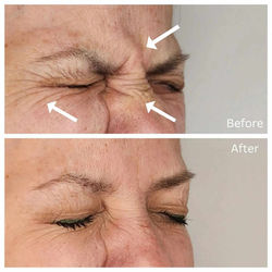 1585a422-bfee-4bf7-9ce5-e4d4560fd2c5