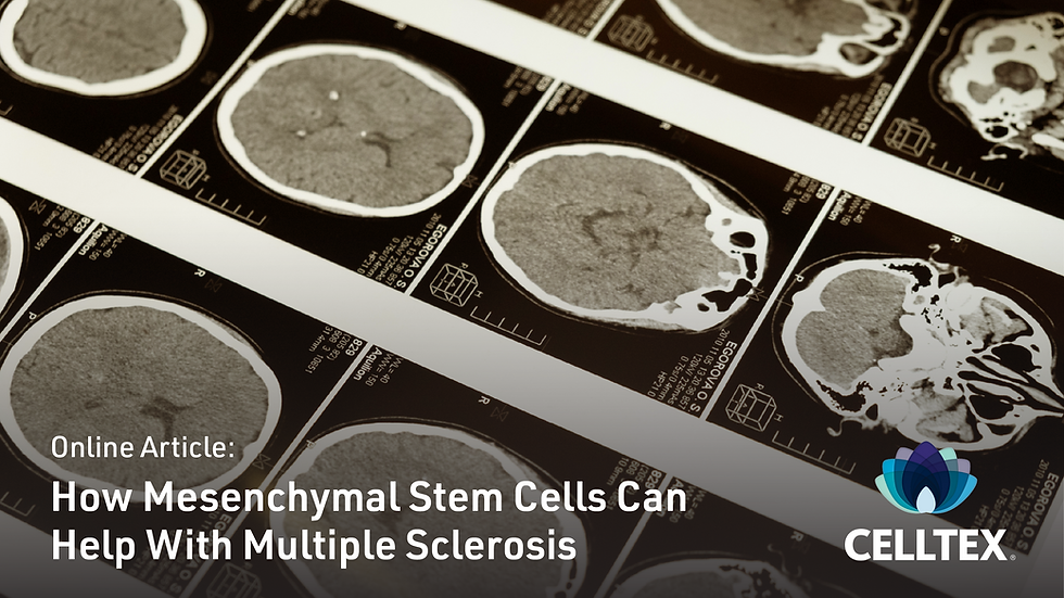 How Mesenchymal Stem Cells Can Help With Multiple Sclerosis