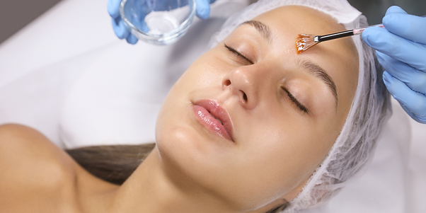 Chemical peel.png