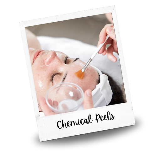 Chemical peel