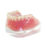 Thumbnail: Dental Teaching Implant Model with Clip Attachments