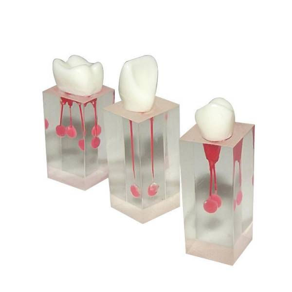 S3 Root Canal Model
