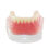 Thumbnail: Dental Teaching Implant Model with Clip Attachments