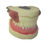 Thumbnail: Maxillary Bilateral Cyst Pus Incision and Removal Practice Dental Teeth Model