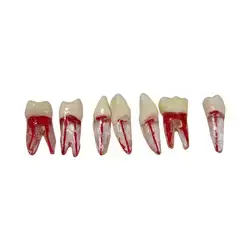 Root Pulp Cavity Model
